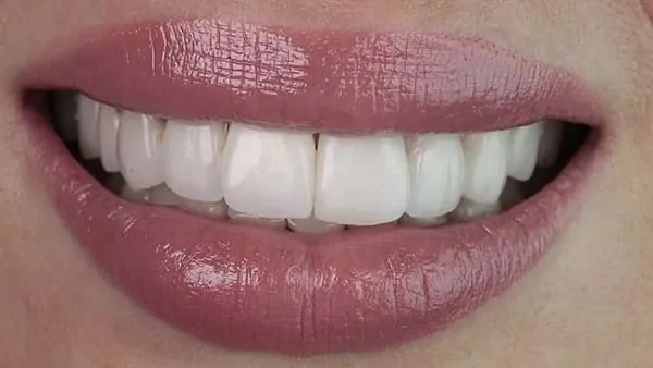 prophylaxie dentaire paris 16 prophylaxie bucco-dentaire docteur spataru roxana