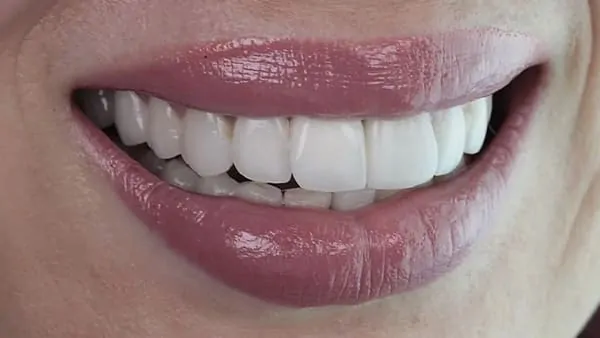 prophylaxie dentaire paris prophylaxie bucco-dentaire docteur spataru roxana